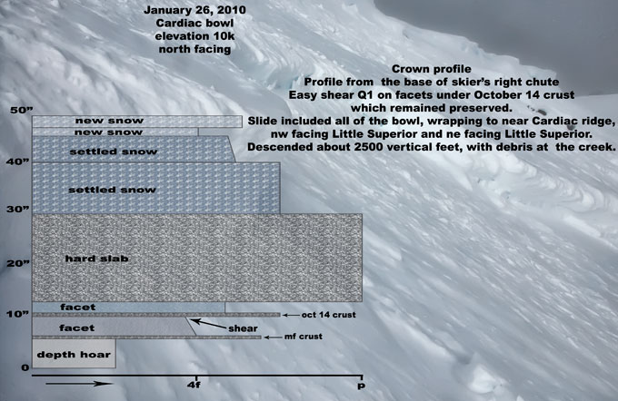 cardiac-snow-profile