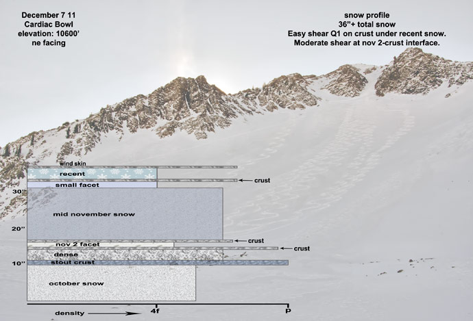 cardiac-snow-profile