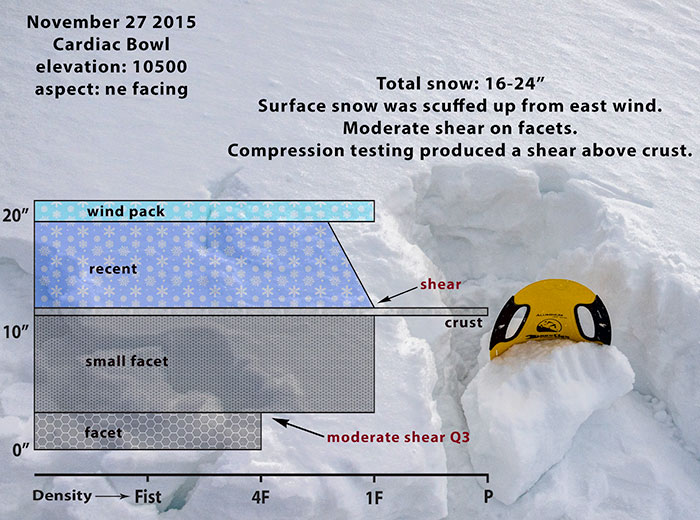 cardiac-snow-profile